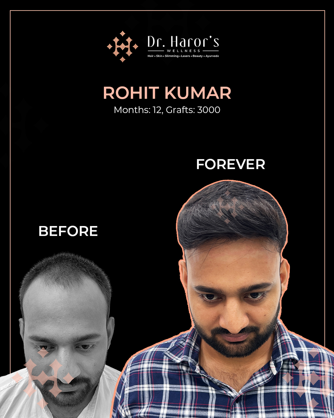 5 - Before and After